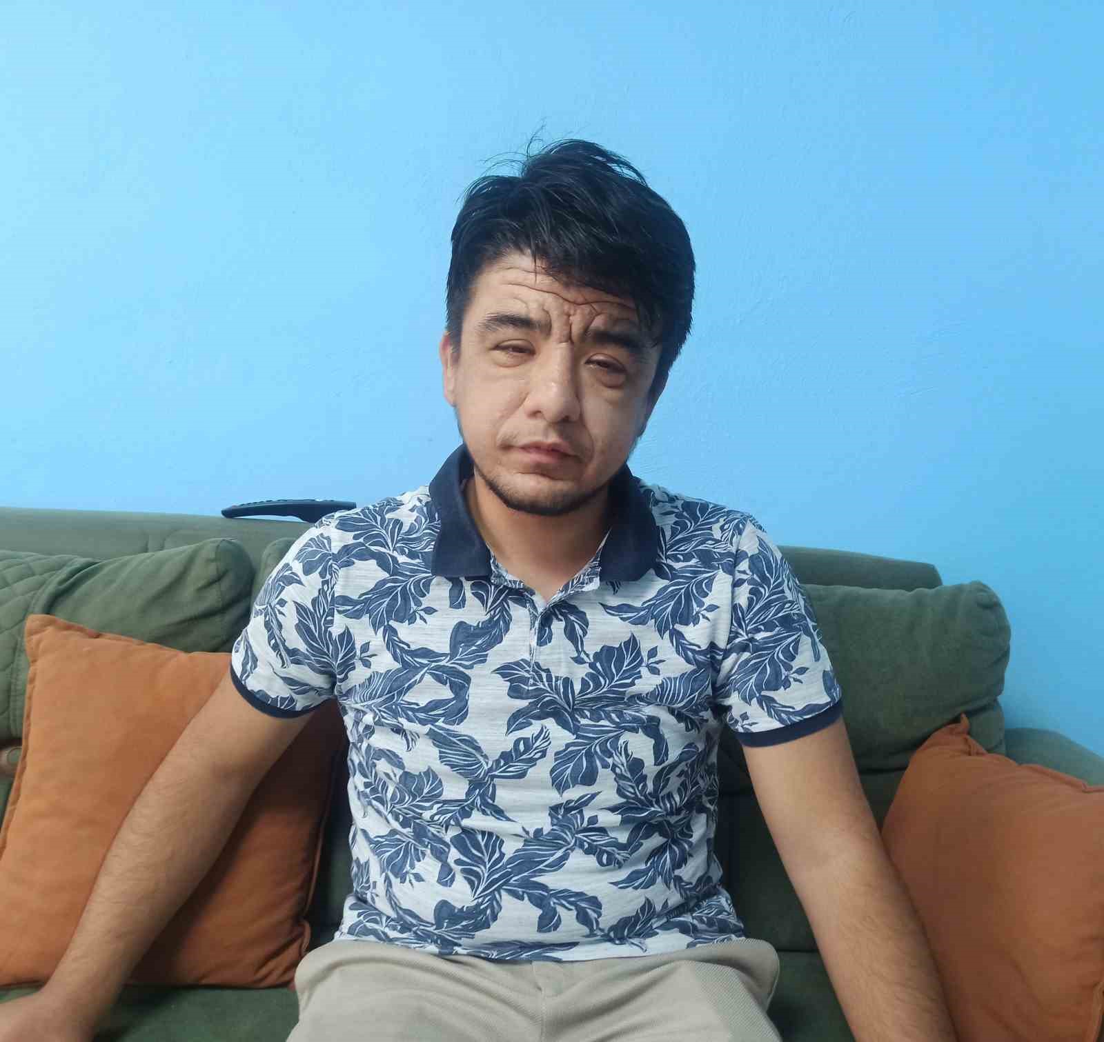 KAHRAMANMARAŞ'TA YAŞAYAN 20 YAŞINDAKİ ENES CENNETER DÜNYADA NADİR GÖRÜLEN ,