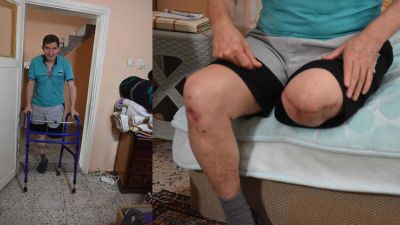 İzmir'de ayağına batan cam parçasının oluşturduğu kesik nedeniyle enfeksiyon kapan