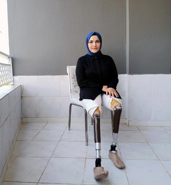Soner AYDIN/MERSİN, (DHA)- MERSİN’de bedensel engelli Zeynep İnce (25), artık kullanılamaz