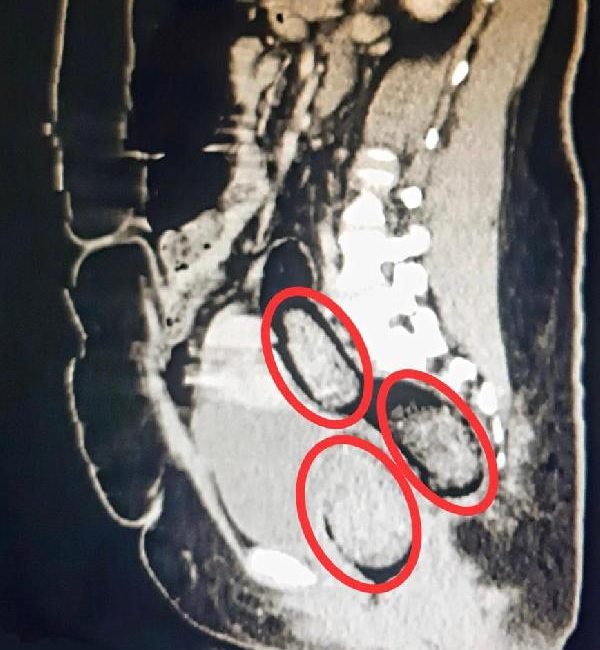 Volkan KARABAĞ/KARS, (DHA)- KARS’ta, polisin durdurduğu yolcu otobüsünde hareketinden şüphelenilen