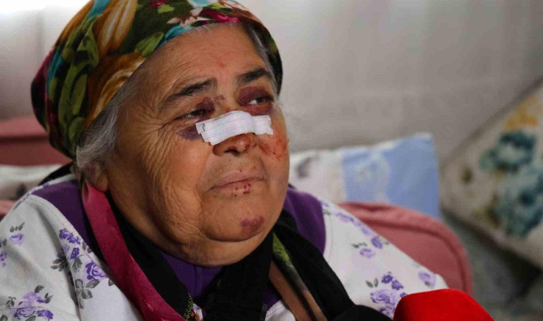 ADANA’DA YAŞLI KADINA FIRINDAN EKMEK ALDIKTAN SONRA EVE DÖNERKEN OTOMOBİL