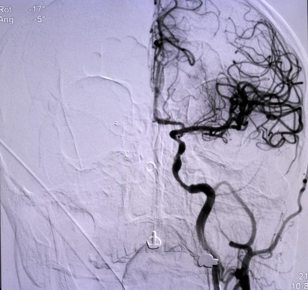 Hasan DÖNMEZ/KONYA, (DHA)- KONYA Şehir Hastanesi Nöroloji Uzmanı Doç. Dr. Gökhan