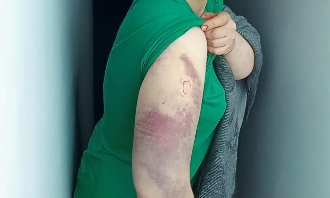 Eskişehir’de eşine şiddet uyguladığı iddiasıyla hakkında soruşturma başlatılan Nevzat Ç.