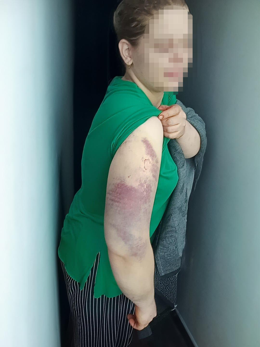 esine eziyet ve cinsel saldiridan tutuklandi 66509d01925cd