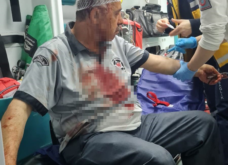Bağcılar’da yabancı uyruklu şüpheliler, bir tekstil firmasının güvenlik görevlisine taş