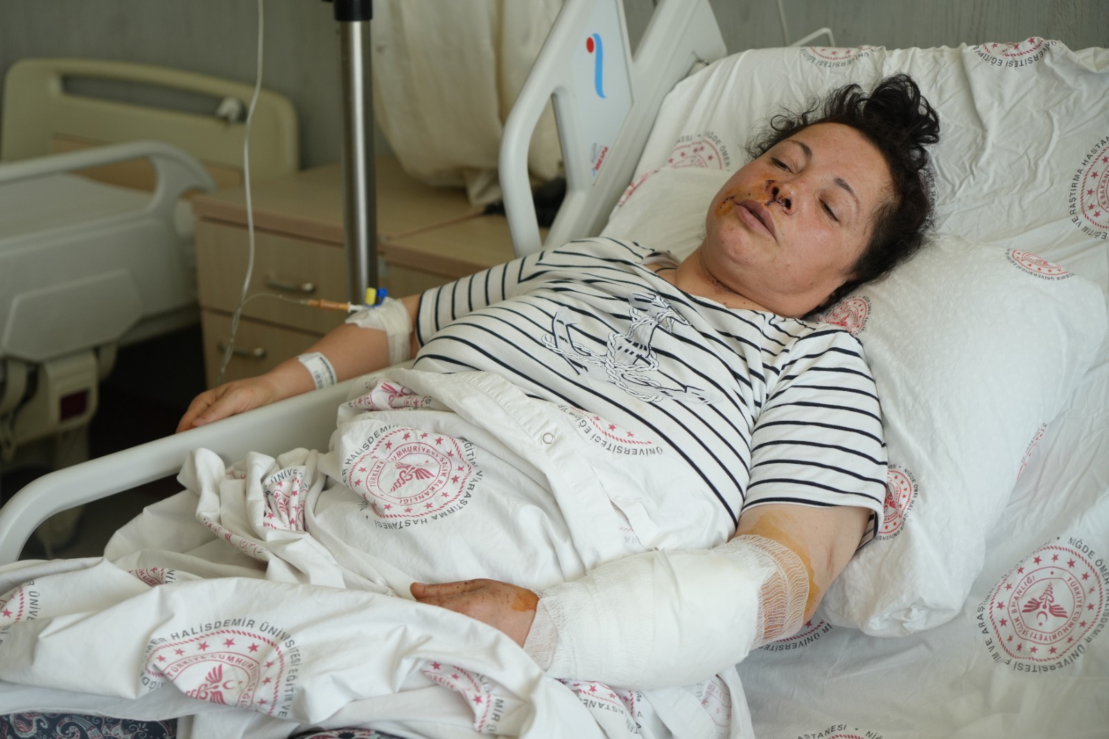 nigdede kadina saldiran rottweiler cinsi kopeklerin sahibi serbest 66a0a60f508a7