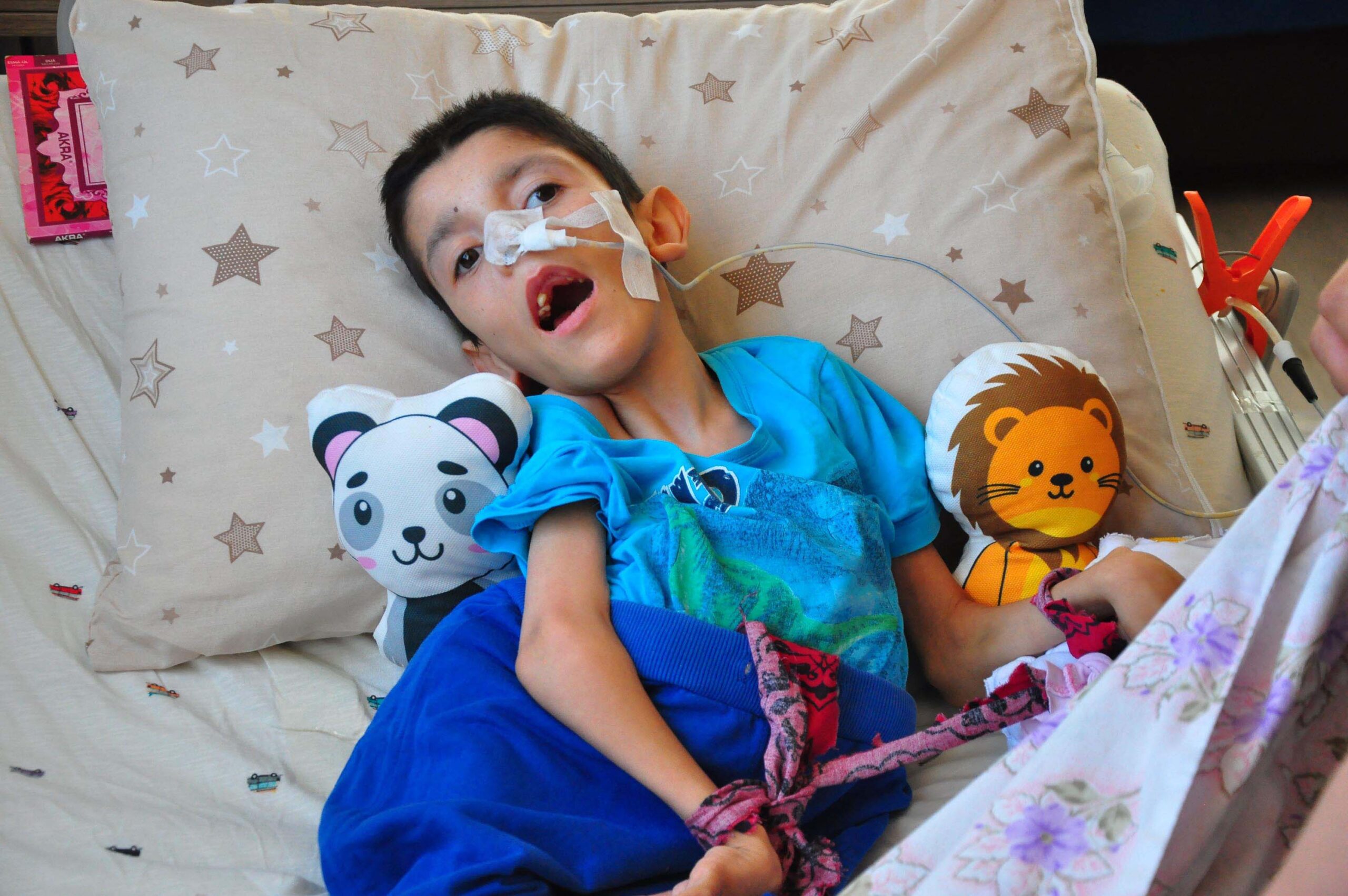 Hidrosefali hastası Osmancan, yaşından çok ameliyat geçirdi