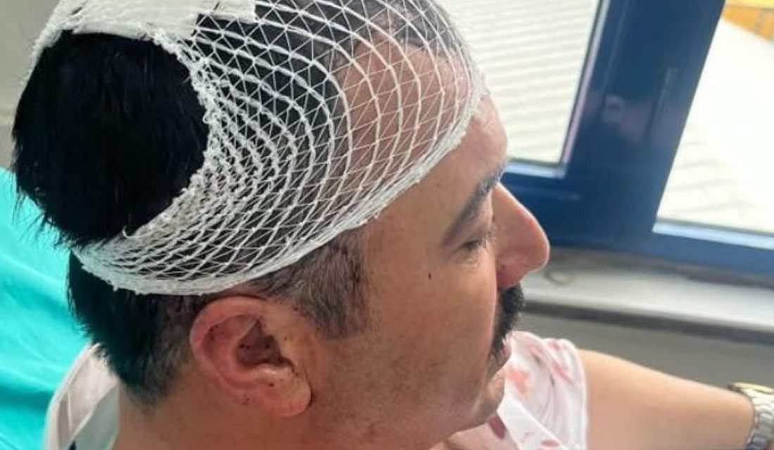 Kahramanmaraş’ta Dulkadiroğlu Belediye Başkan Yardımcısı Latif Öztürk’ün, makamında saldırıya uğradığı