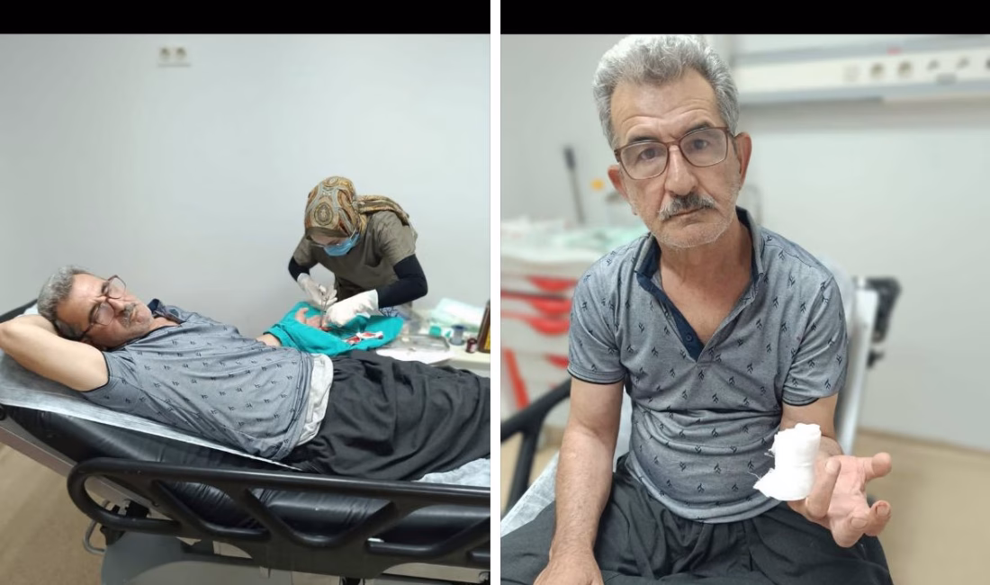 ADANA, -ADANA’da karpuz kesmeye çalışan kebapçı Eyüp Davşan (60), sol