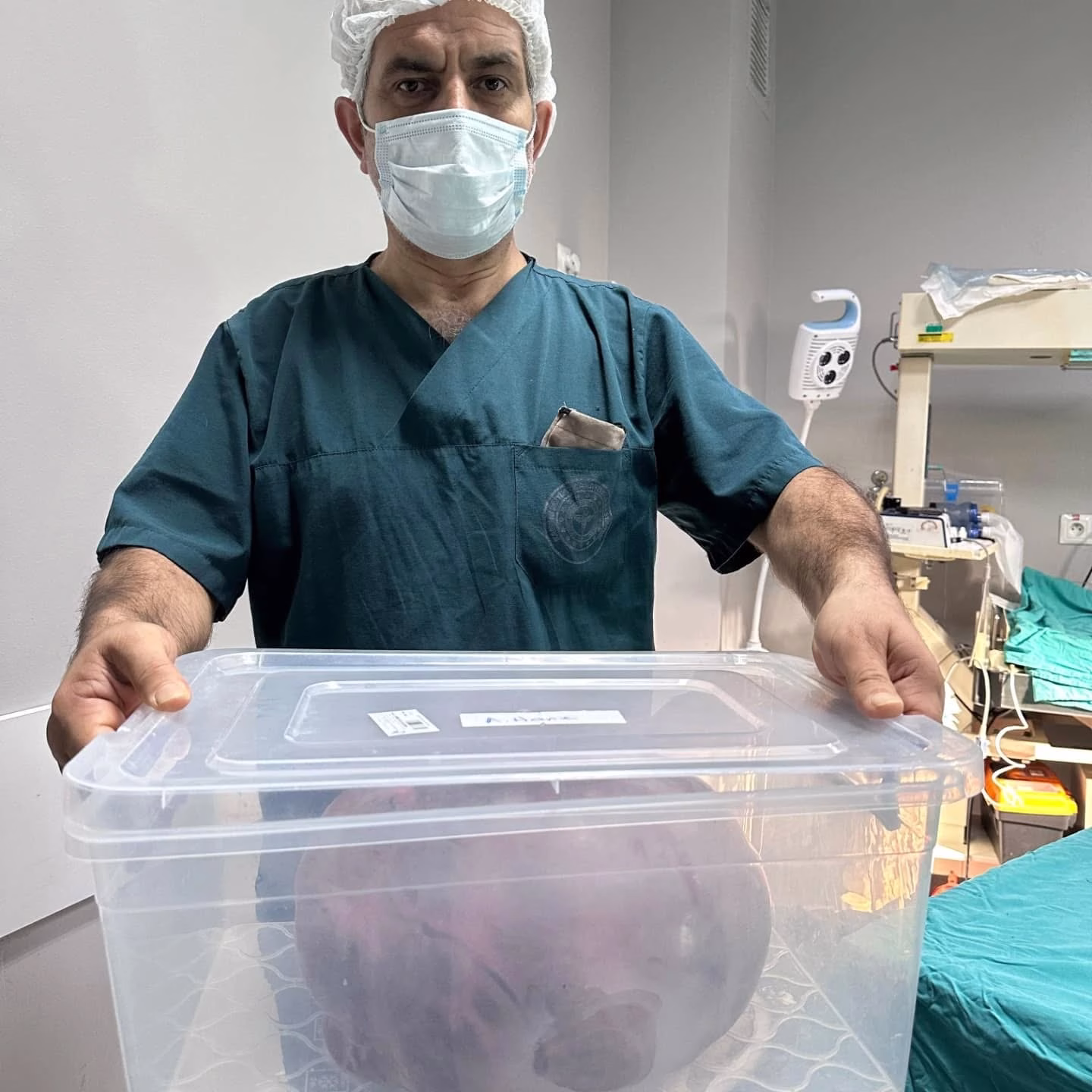 Yumurtalıklarındaki kiloluk kitle operasyonla çıkarıldı