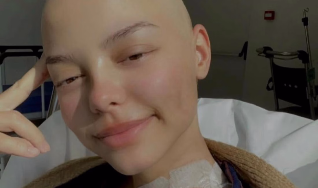 Ruken KADIOĞLU-Canberk ÖZTÜRK/ANKARA, – ANKARA’da 2 yıldır lenf kanseri ile