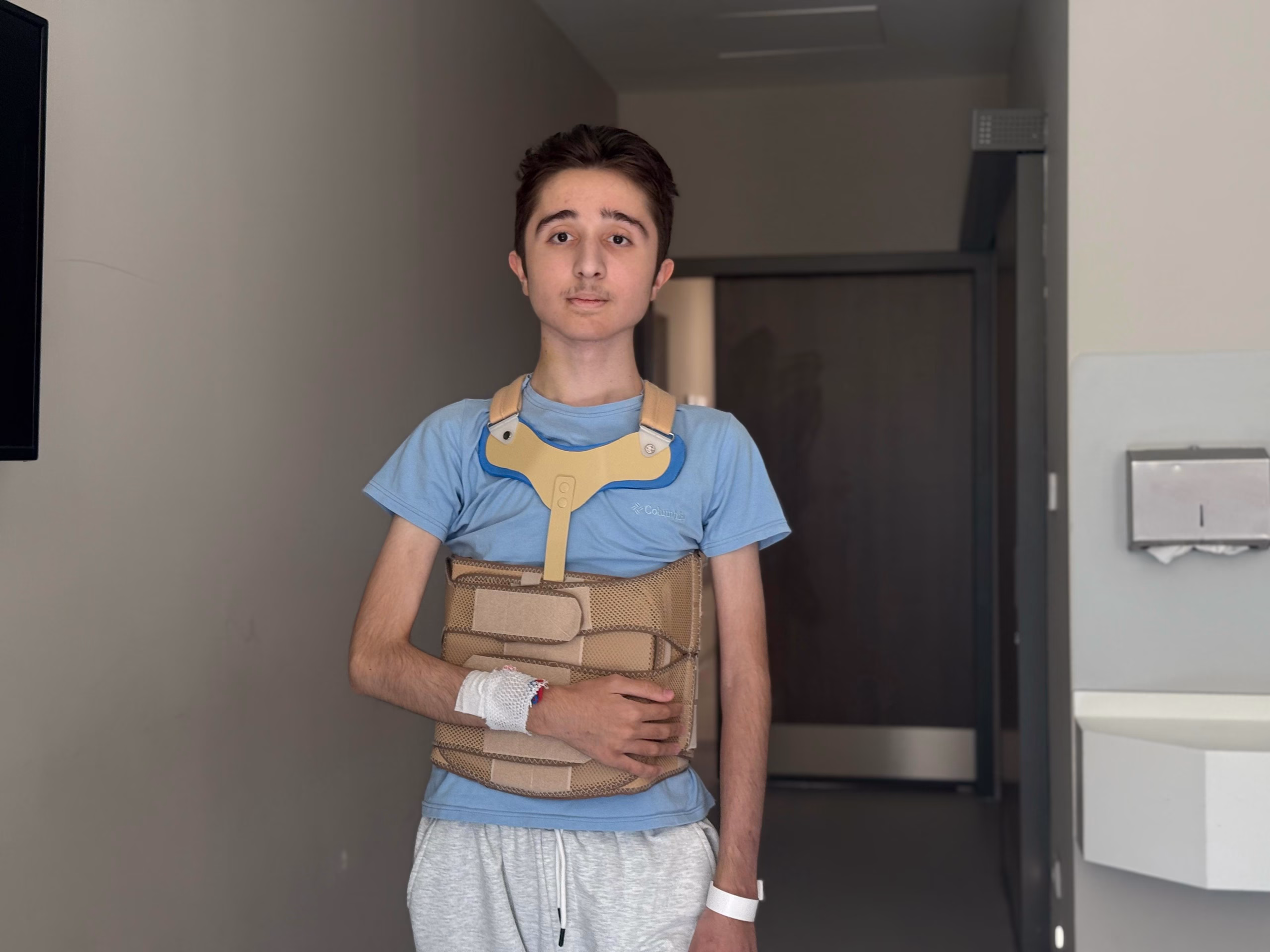 Liseli Eren, 2 seanslık ameliyat ile skolyozdan kurtuldu Liseli Eren, seanslık ameliyat ile skolyozdan kurtuldu