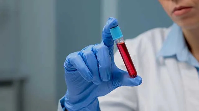 Prostat Kanseri Hakkında Doğru Bilinen 7 Yanlış