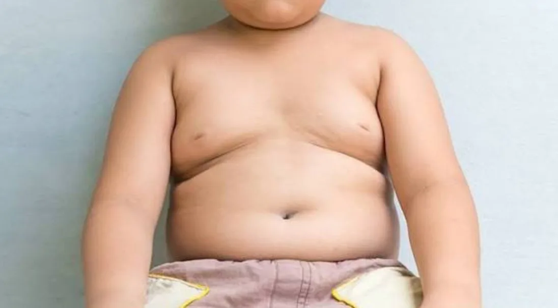 Dünya Sağlık Örgütü (DSÖ), çocuk ve ergenlerde obezitenin dünya genelinde